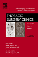 Thoracic Surgery Clinics